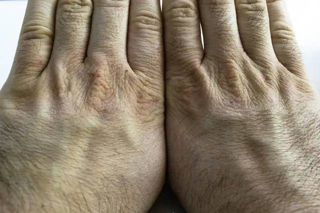 人活多久看手掌就能知？医生直言：长寿的人，手掌或有这3个特征